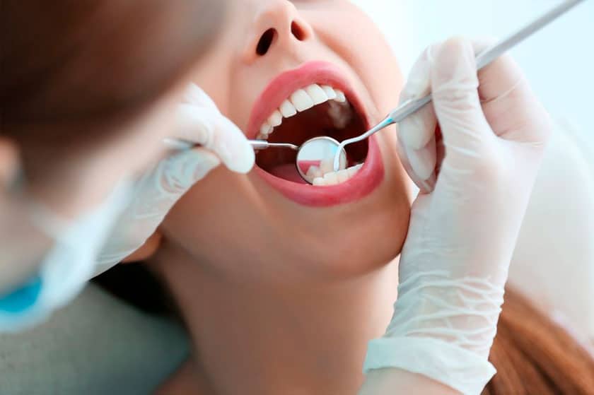 Avulsión dentaria. Qué es y cómo salvar el diente.