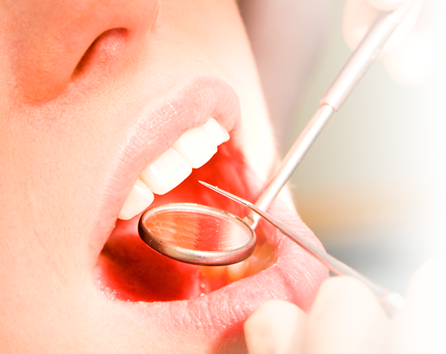 Empaste dentales | obturaciones dentales