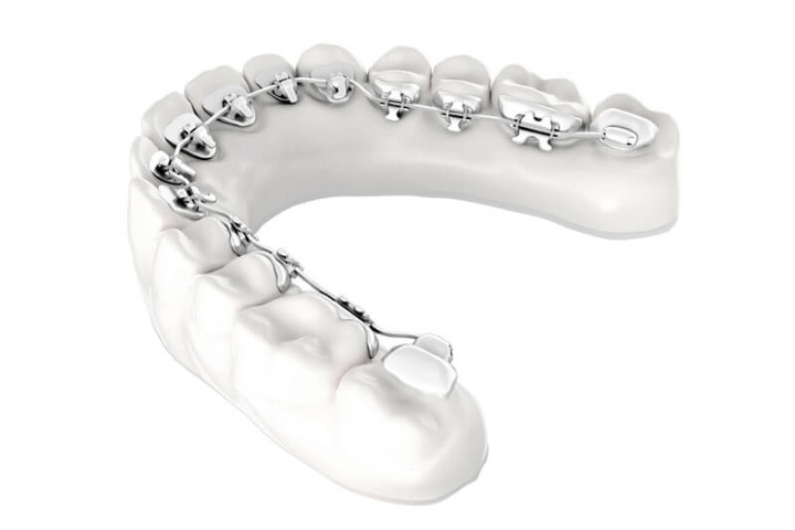 Ortodoncia Estética Dental las rozas