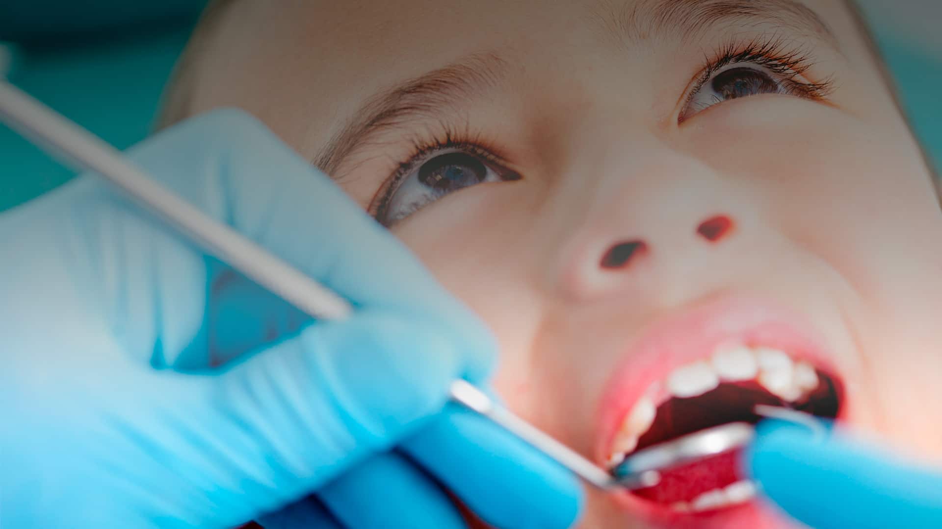 Tipos de ortodoncia en niños