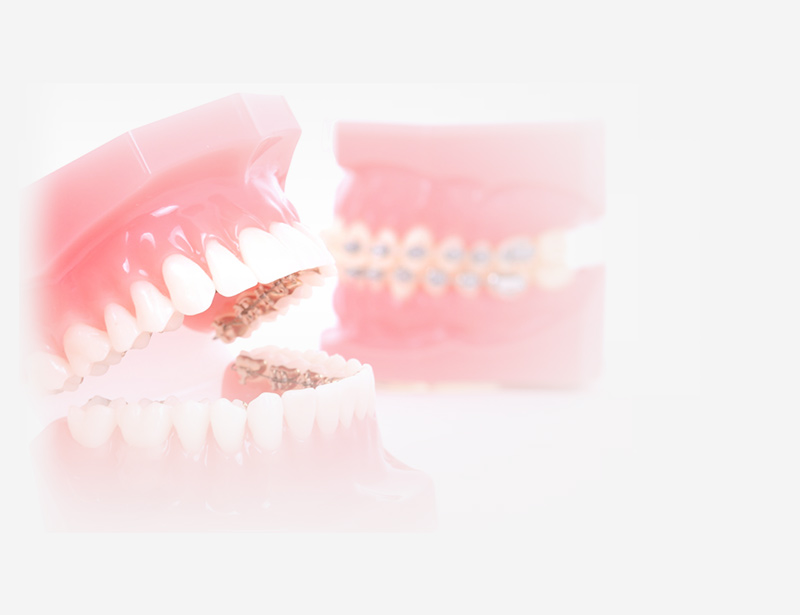 ortodoncia estética