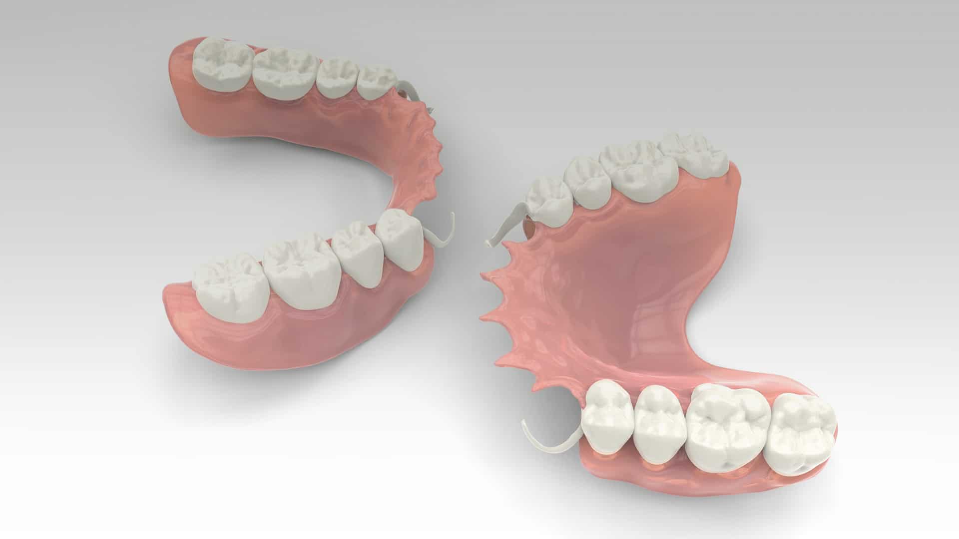 Tratamiento de prótesis dentales removibles