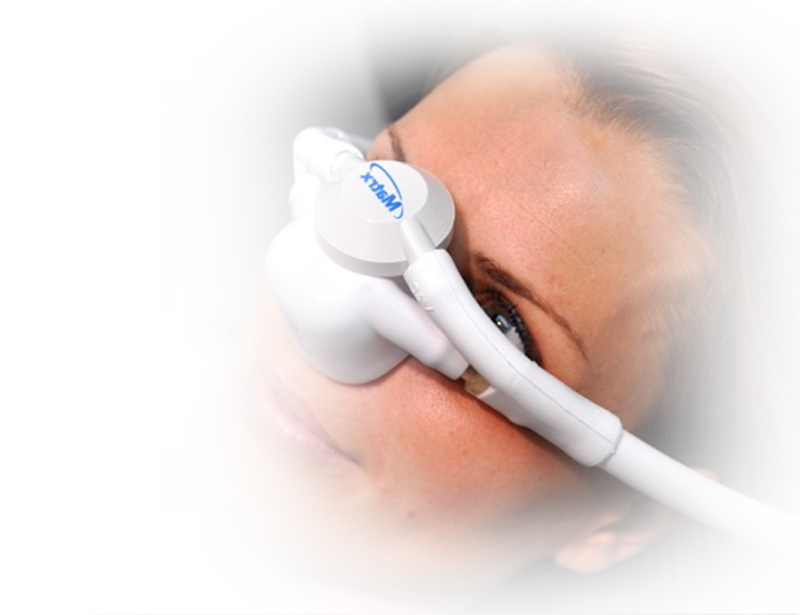 Beneficios de la sedación en odontología