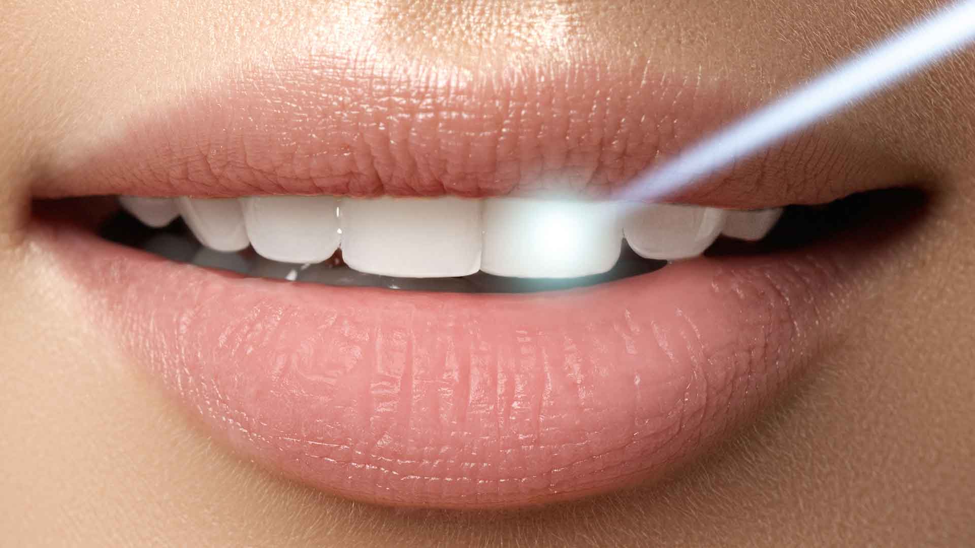 Beneficios del uso del láser en la periodoncia y la endodoncia