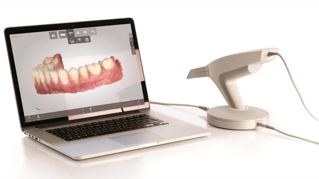Tecnologías dentales: Escáner intraoral