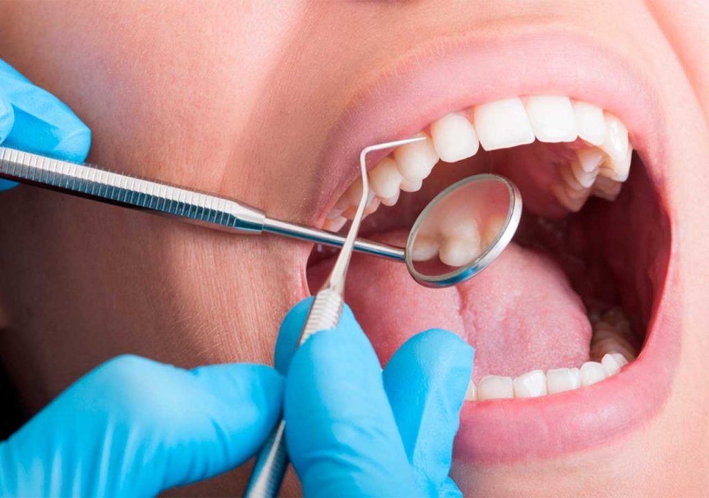 Consejos de limpieza de boca del dentista: acude al consultorio
