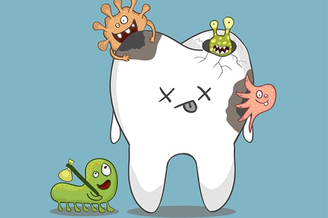 La caries dental y tus hábitos alimenticios