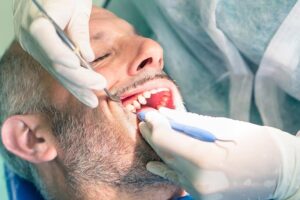¿es molesta la cirugía de implantes dentales?