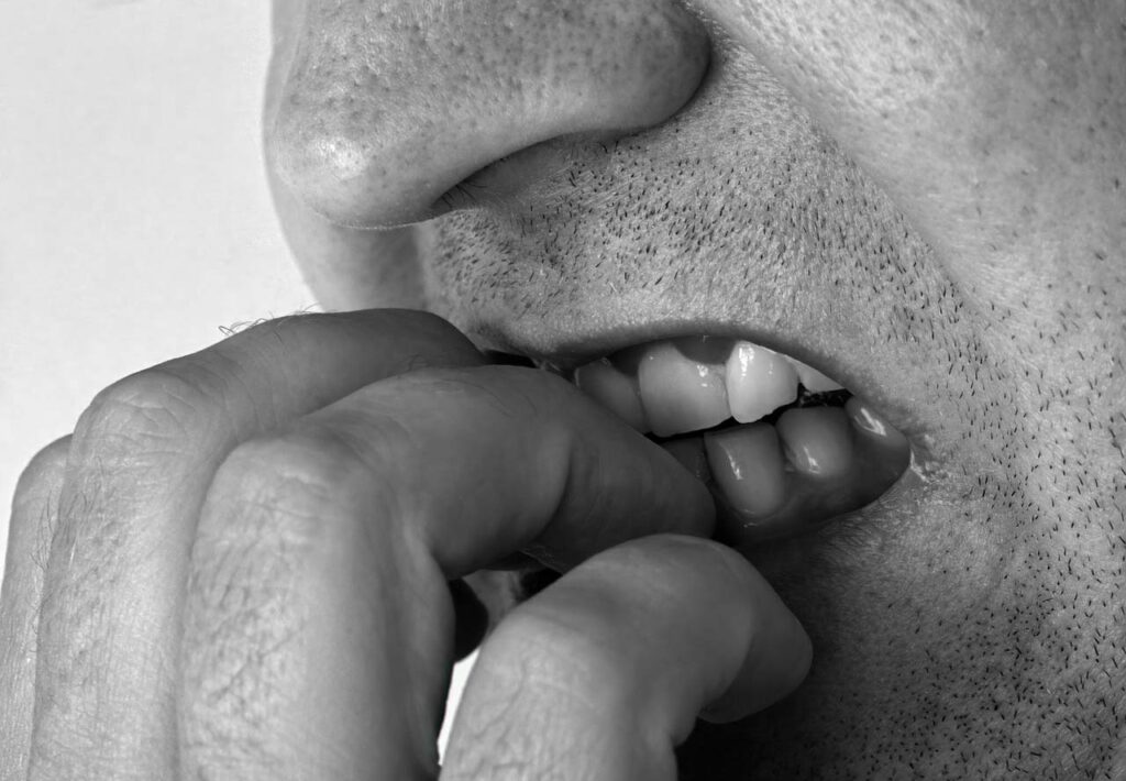 Onicofagia consecuencias en la dentadura de morderse las uñas