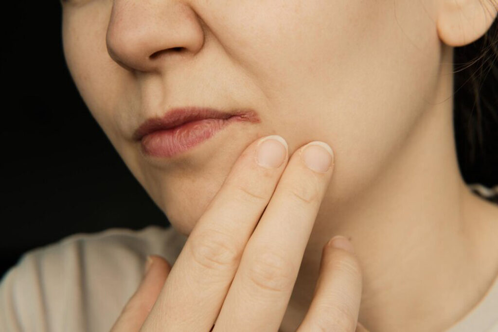 secretos del herpes labial